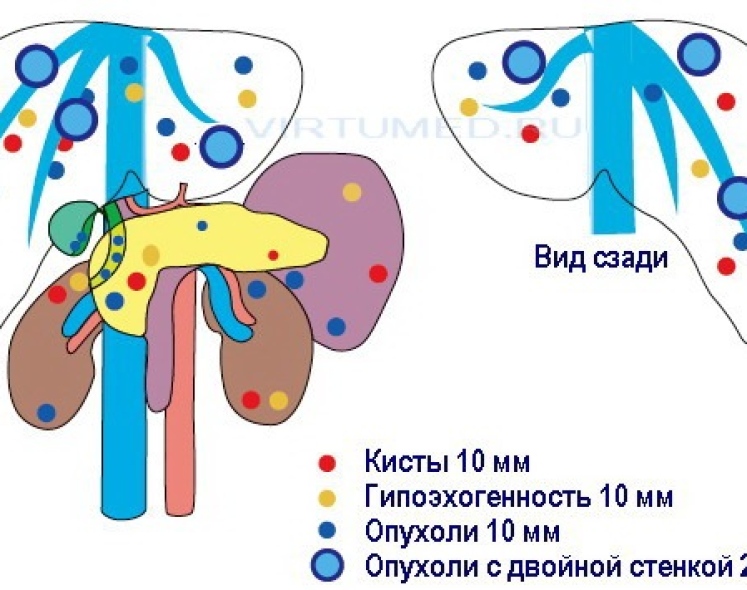 ВиртУЗИ