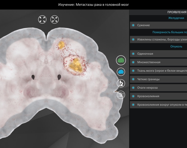 Патолоджи3D (Pathology3D)