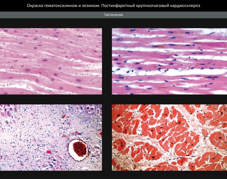 Патолоджи3D (Pathology3D)